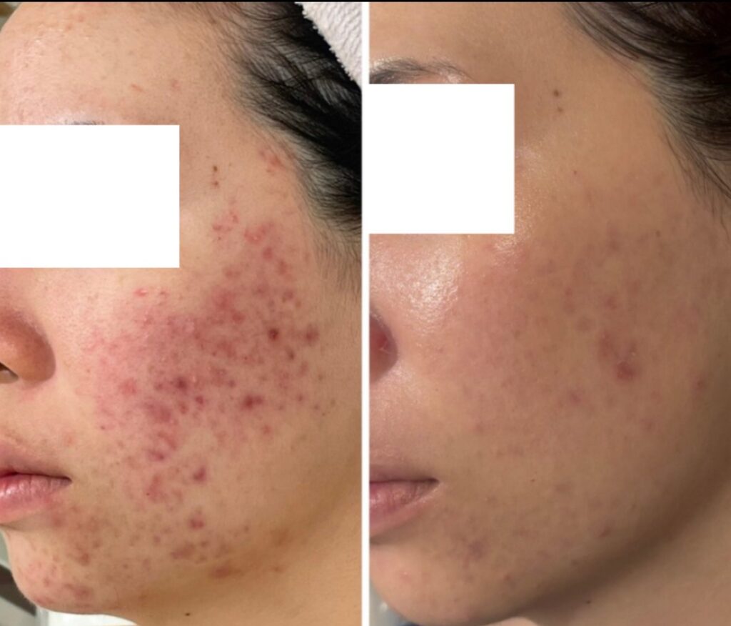 line_oa_chat_251115_123313