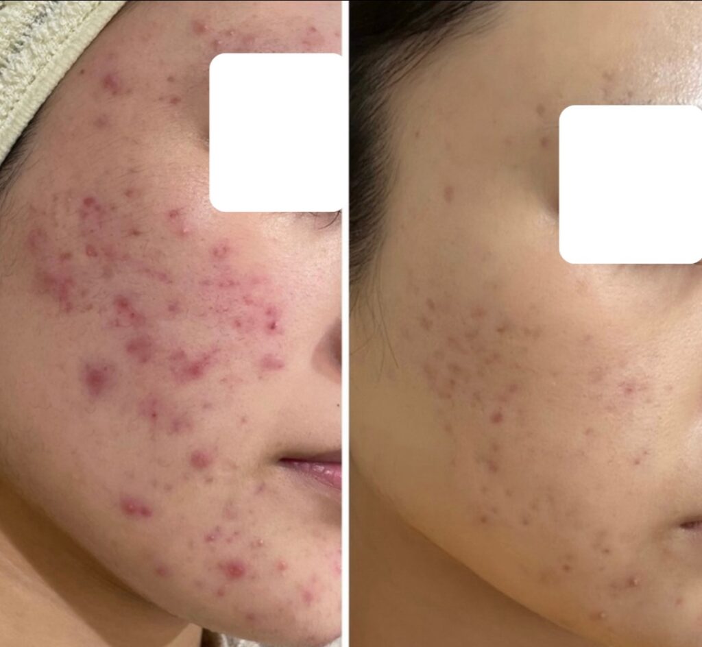 line_oa_chat_251115_123315