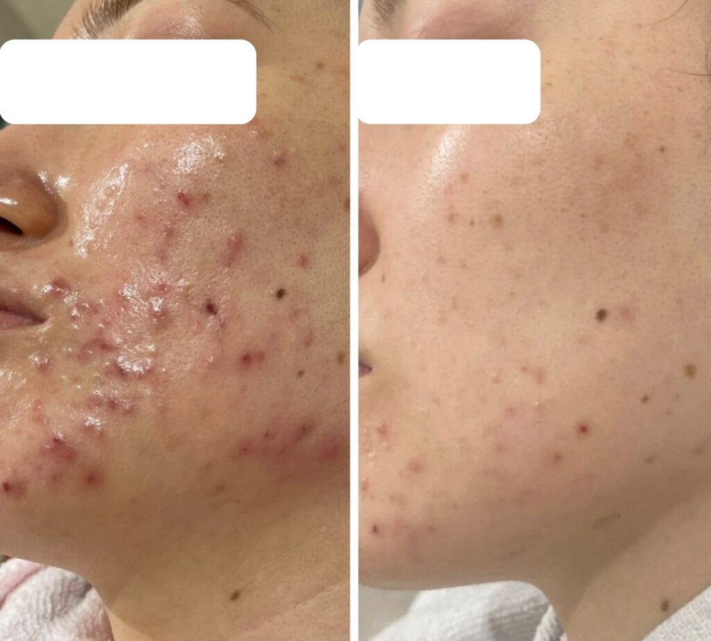 line_oa_chat_251115_123317