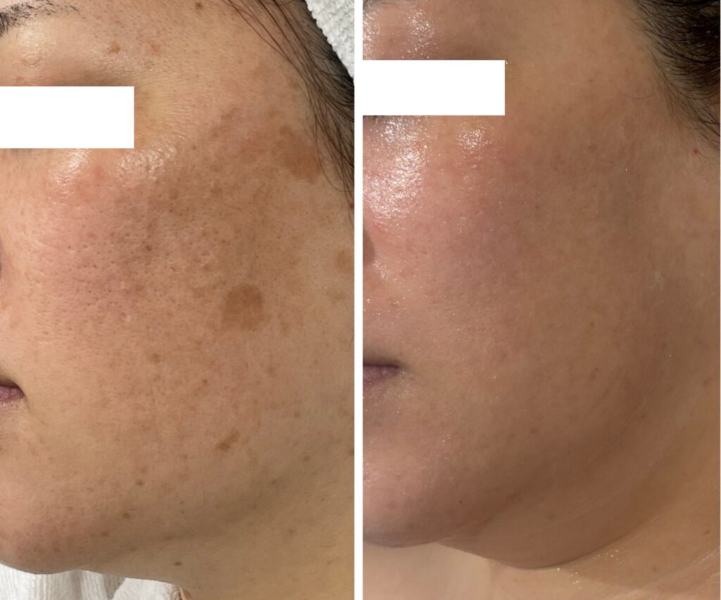 line_oa_chat_251115_123319