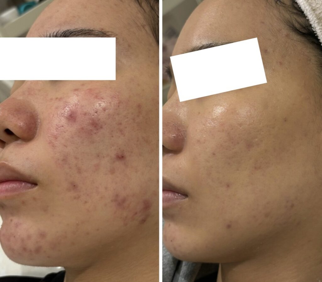 line_oa_chat_251115_123329