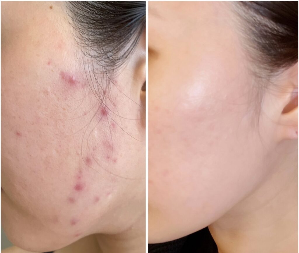 line_oa_chat_251115_123334