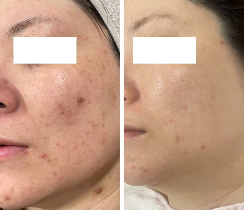 line_oa_chat_251115_123342